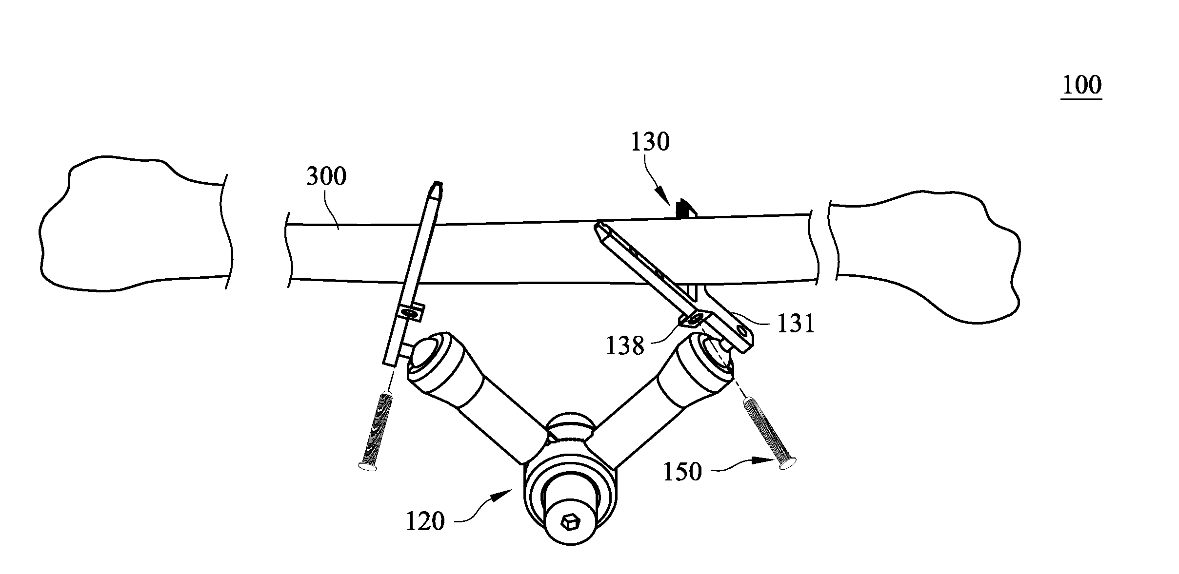 Measuring and guiding device for reconstruction surgery