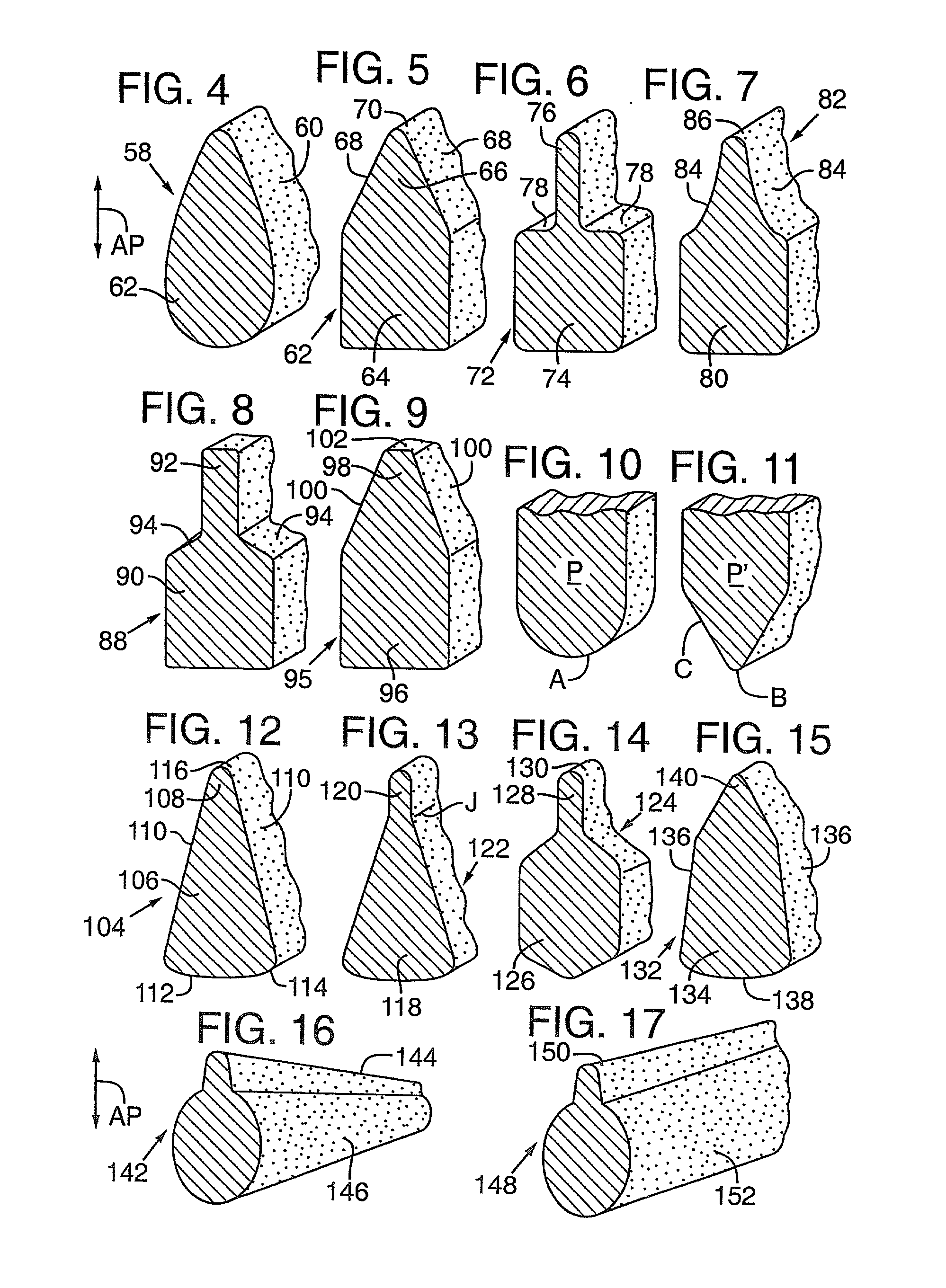 Administration of therapeutic or diagnostic agents using interlabial pad