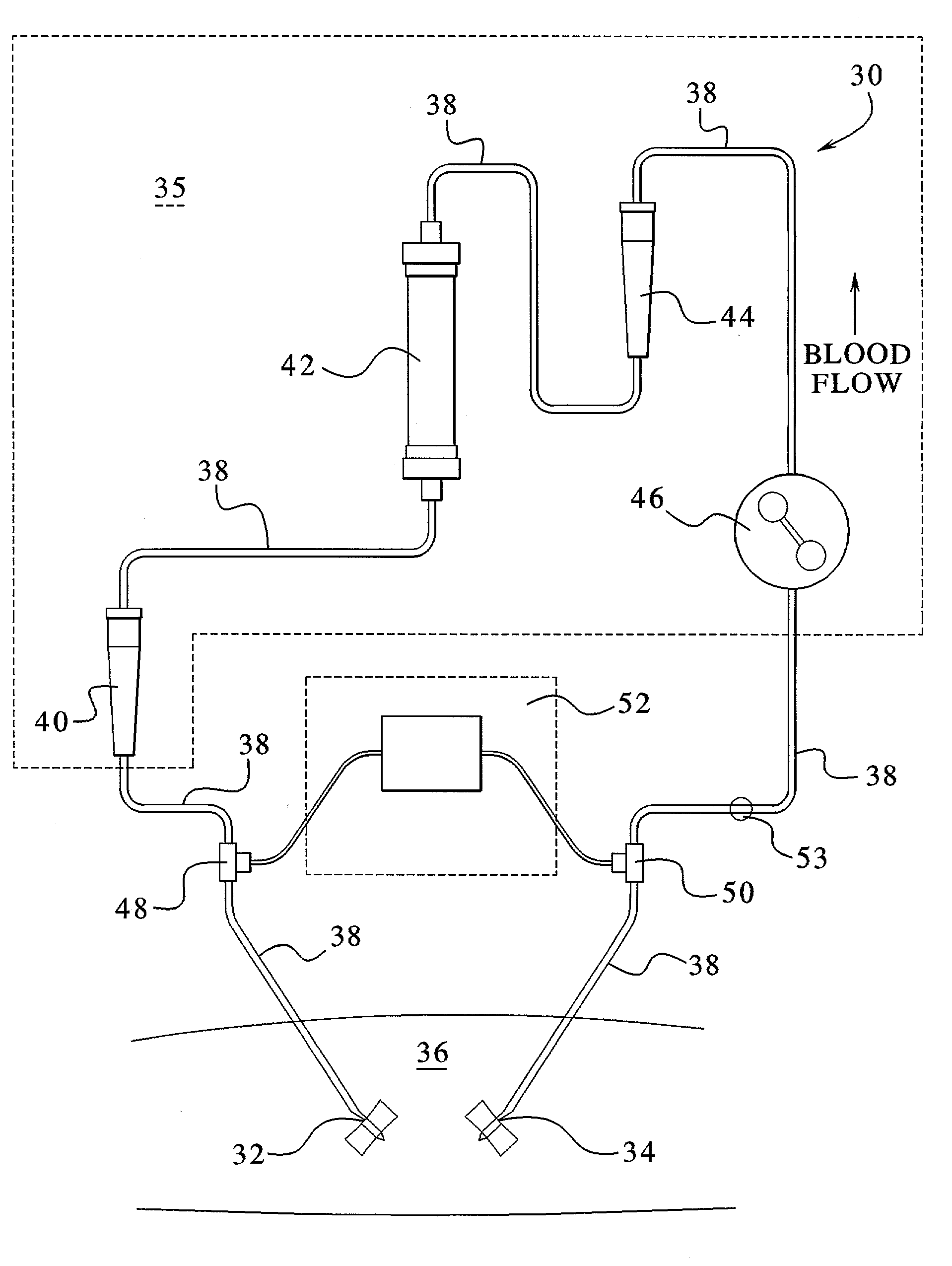 Access disconnection system and methods