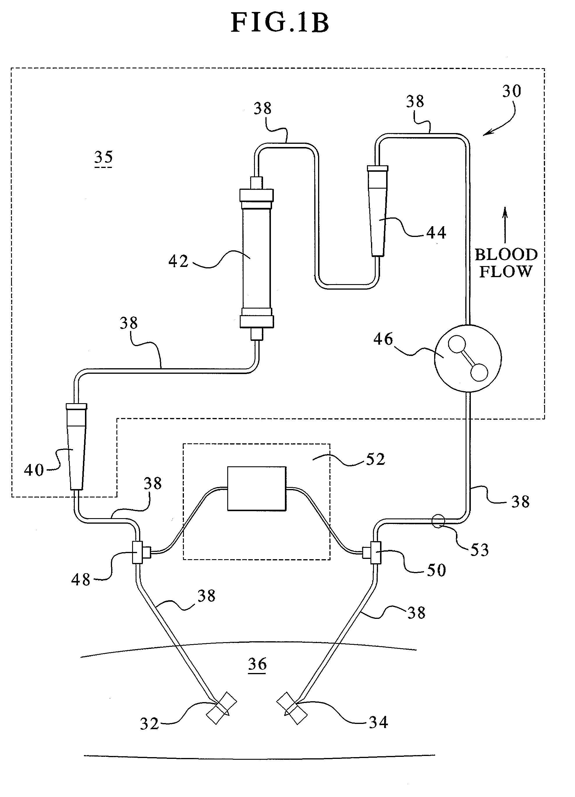 Access disconnection system and methods