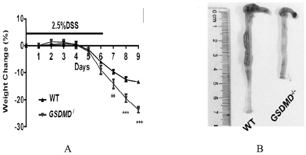 Application of gsdmd protein and its target in the preparation of drugs for treating inflammatory bowel disease