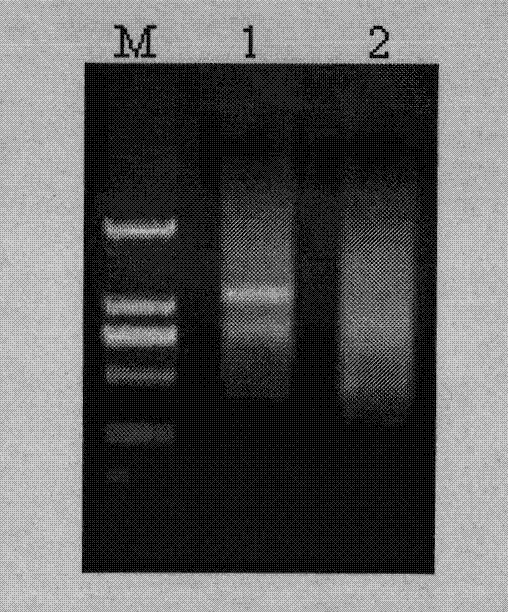 Grapevine powdery mildew resistance transcription factor gene VpRFP1 promoter sequence and application thereof