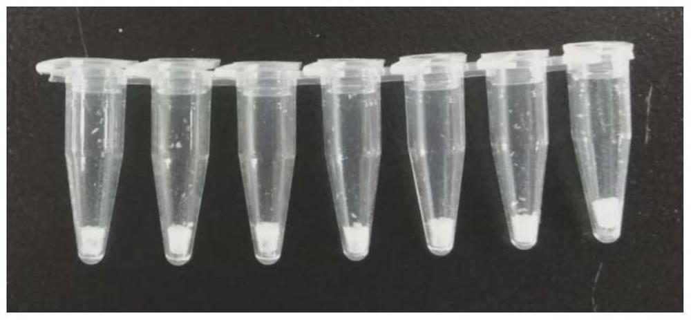 Primer group for detecting mycoplasma pneumoniae, kit and method