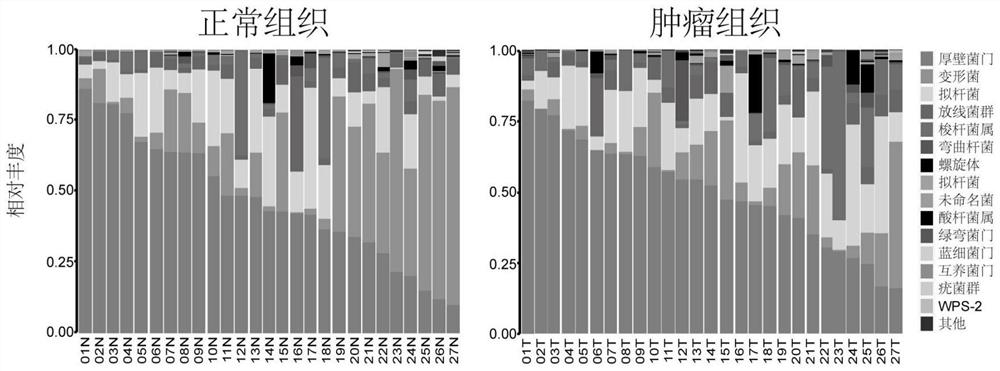 Marker for predicting curative effect of tumor chemotherapy combined with immunotherapy and application thereof