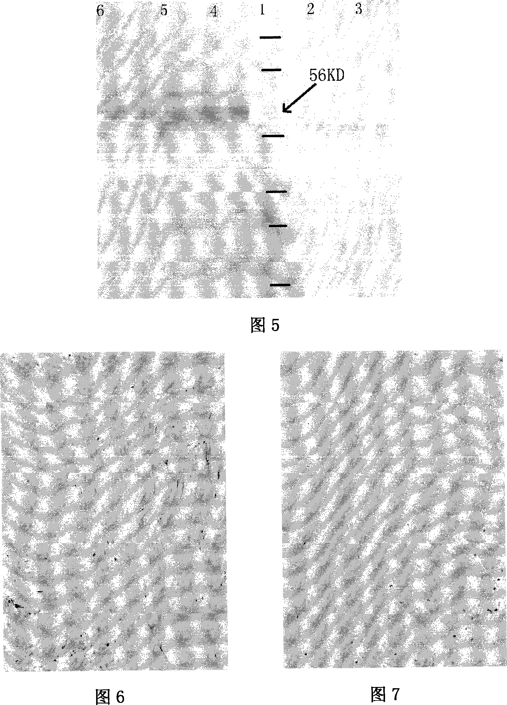 Human papillomavirus shell protein L1 short peptide and application thereof