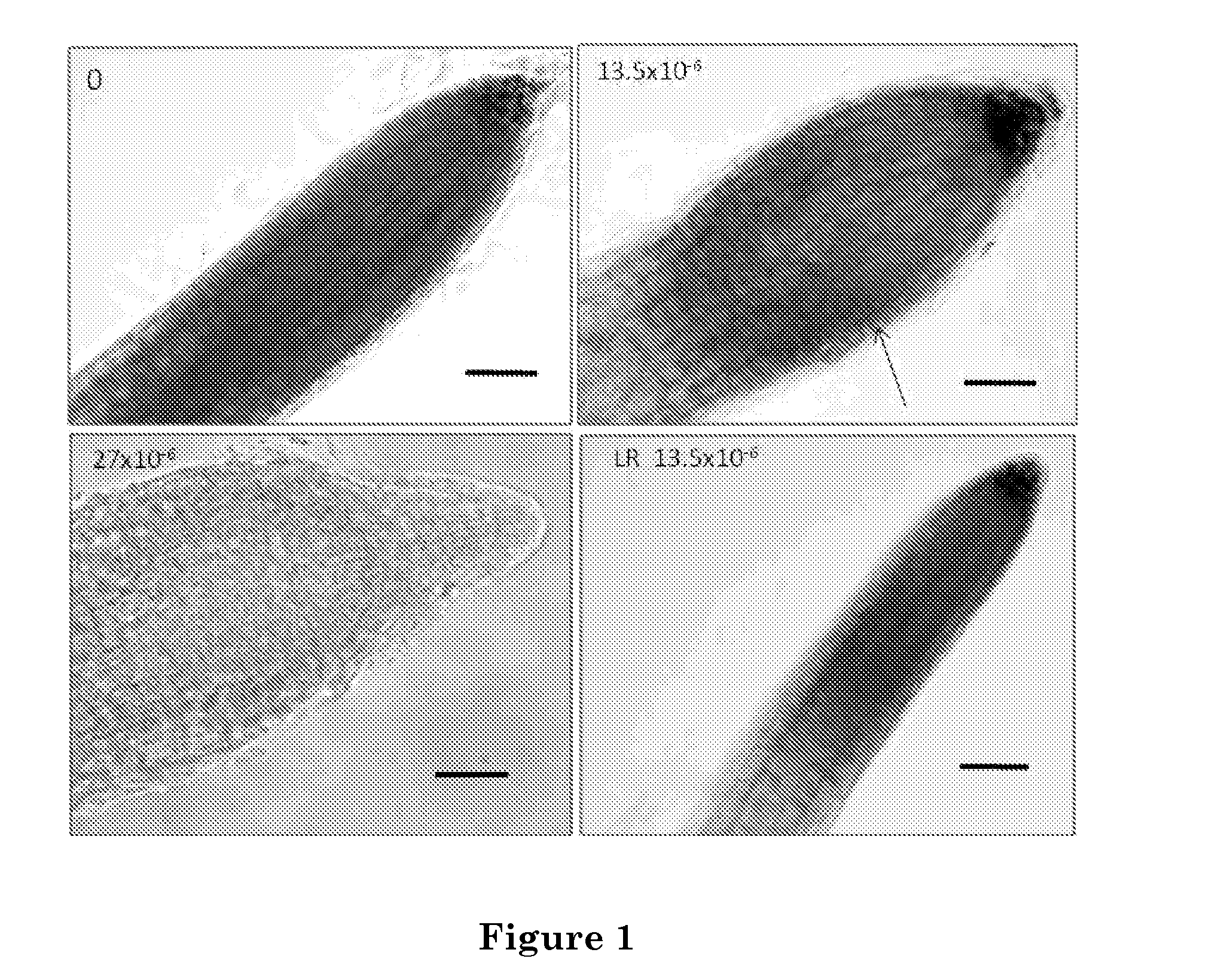 Use of strigolactones and strigolactone analogs for treating proliferative conditions