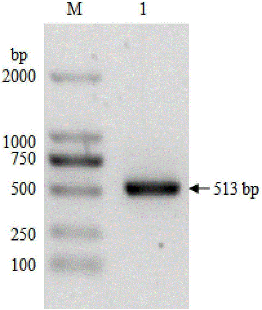 Construction and expression of lactic acid bacteria for recombination of GP5 gene of porcine reproductive and respiratory syndrome virus