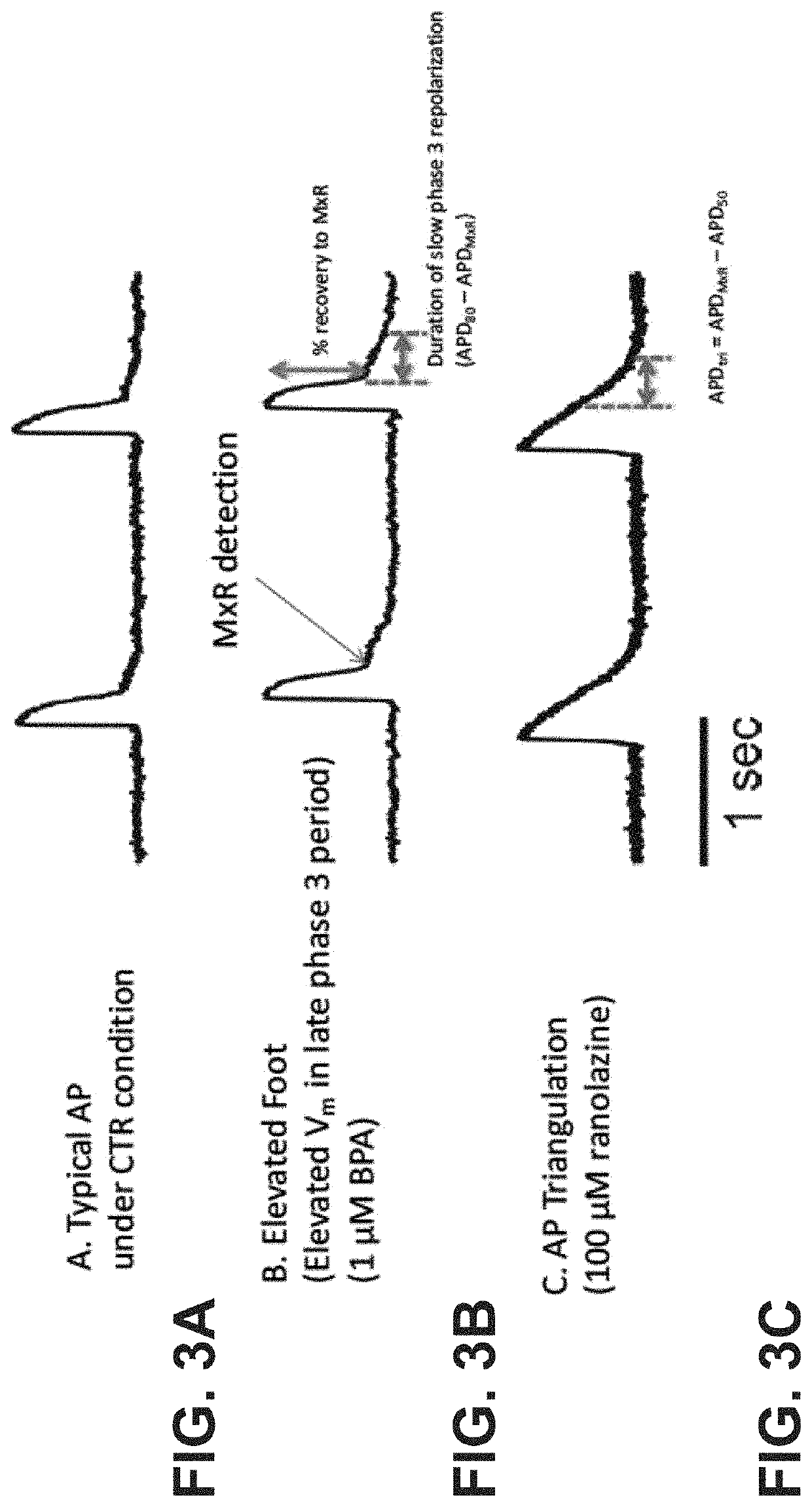 Human in vitro cardiotoxicity model