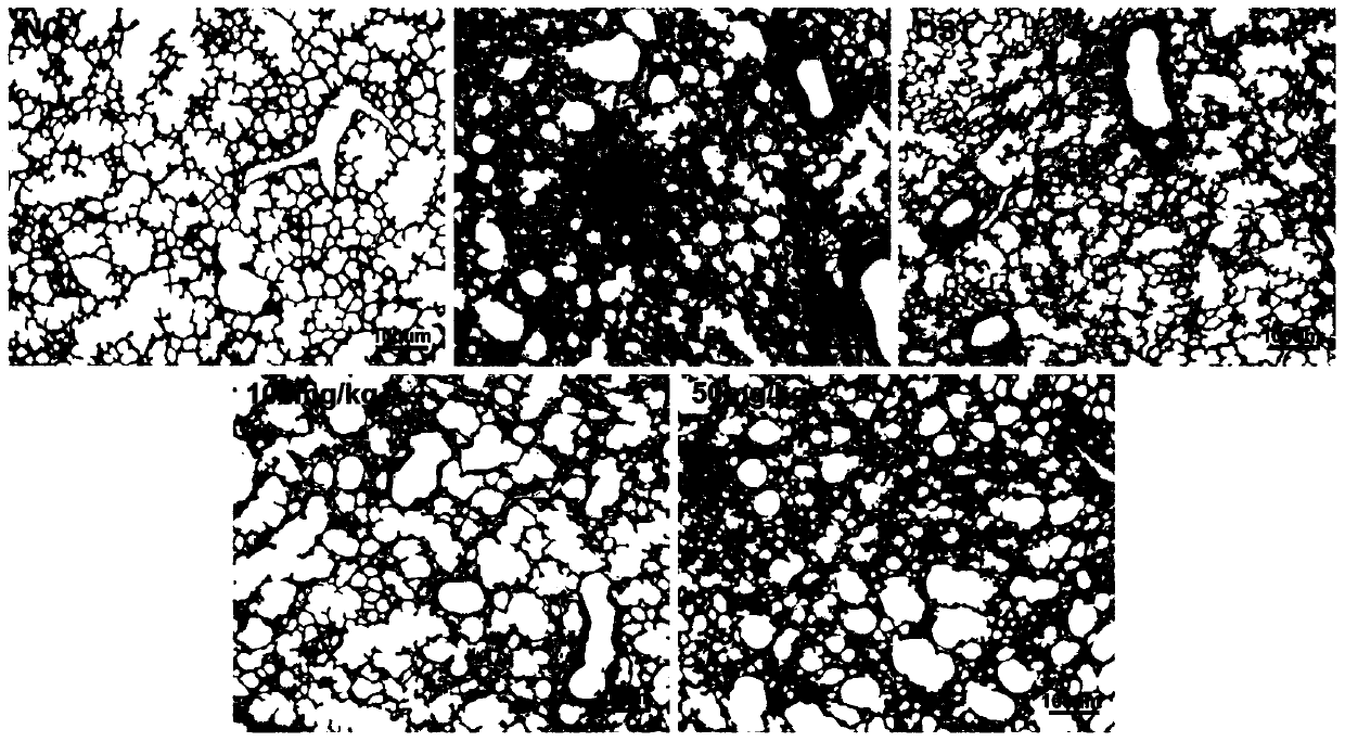 Application of Liu-Shen-Wan in preparation of medicines for preventing and treating flu-type inflammatory diseases