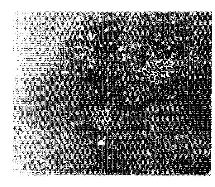 Corneal posterior lamella and use thereof