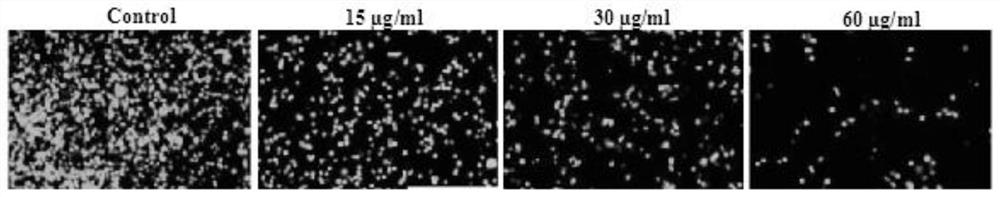 Application of Indian kalimeris herb cold and wind chill compound recipe to preparation of medicines for resisting infection with novel coronaviruses