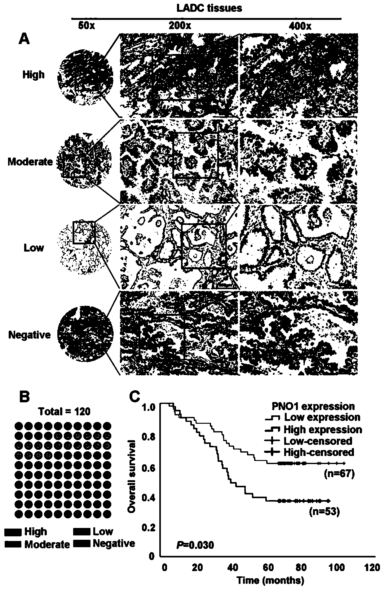 Application of human PNO1 gene in lung cancer and related product