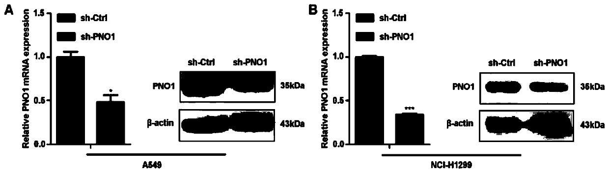 Application of human PNO1 gene in lung cancer and related product