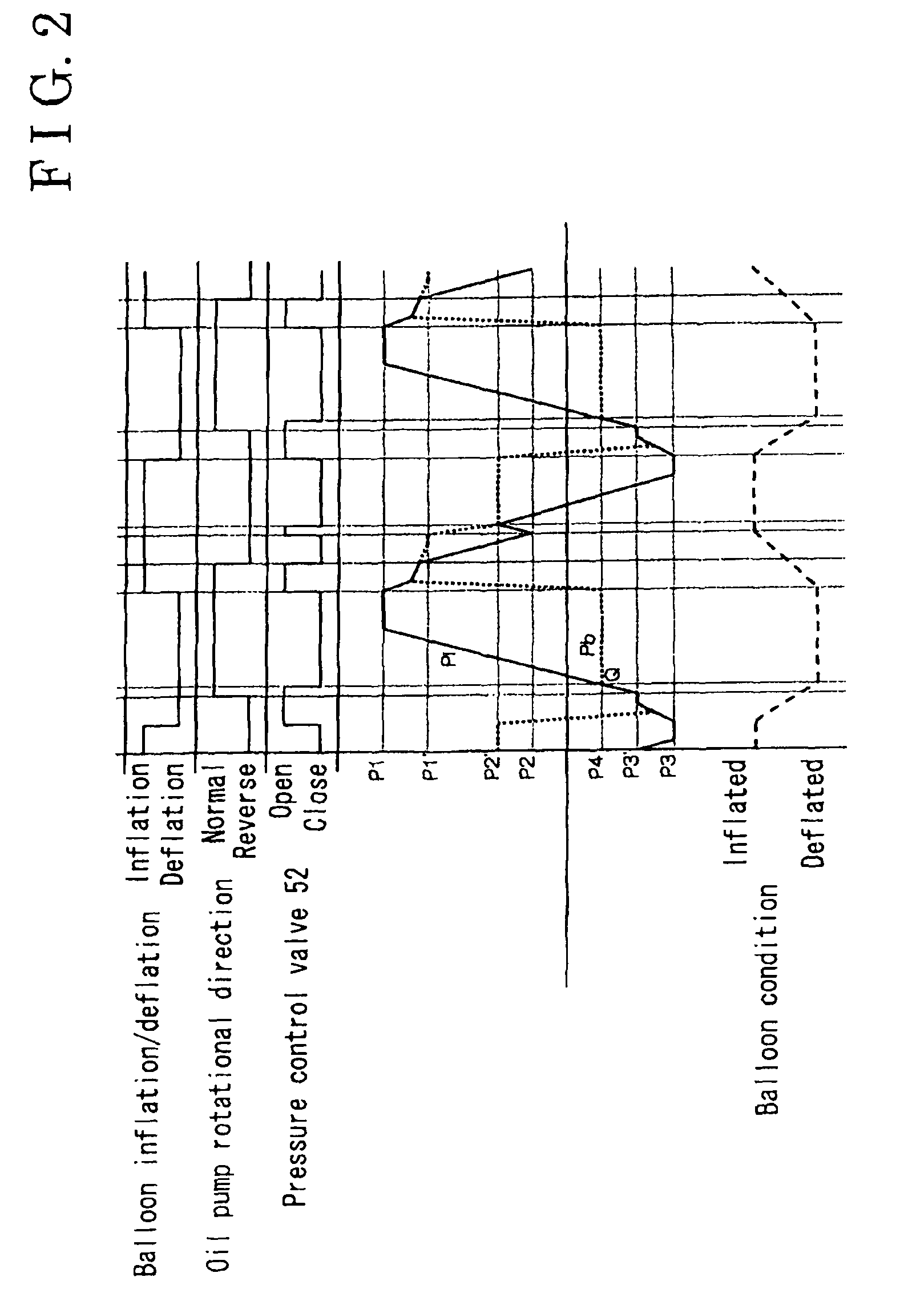 Method of balloon pumping and a balloon pump driving apparatus