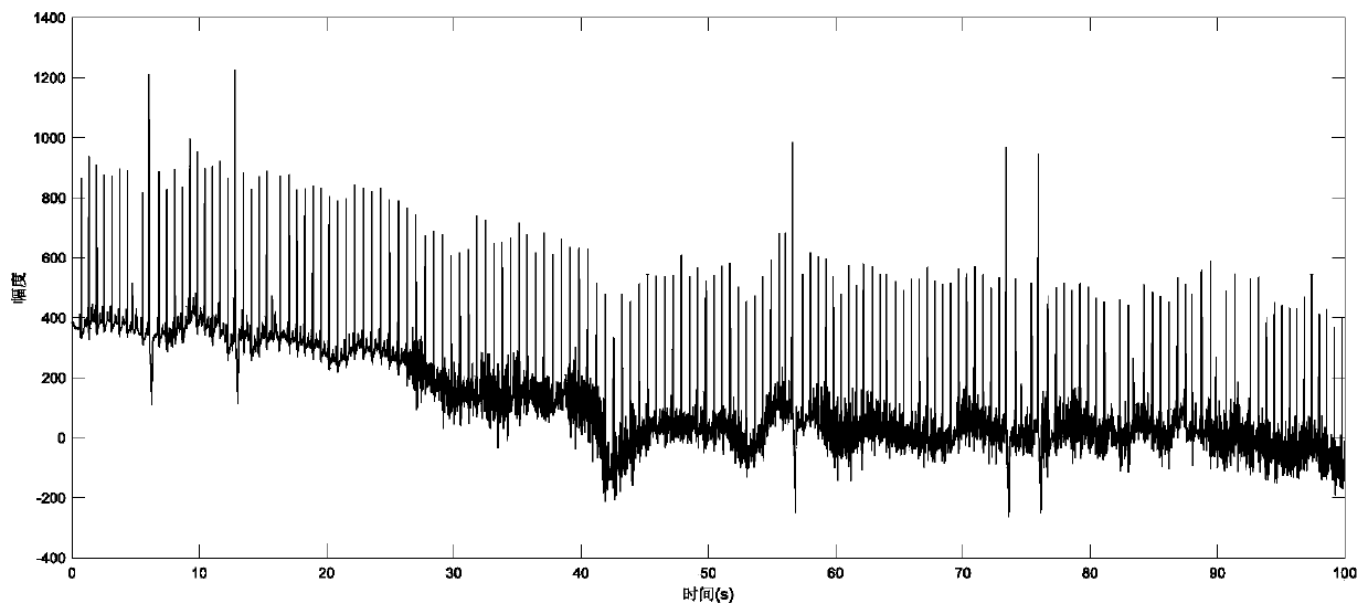 Improved electrocardiosignal quick clustering analysis method