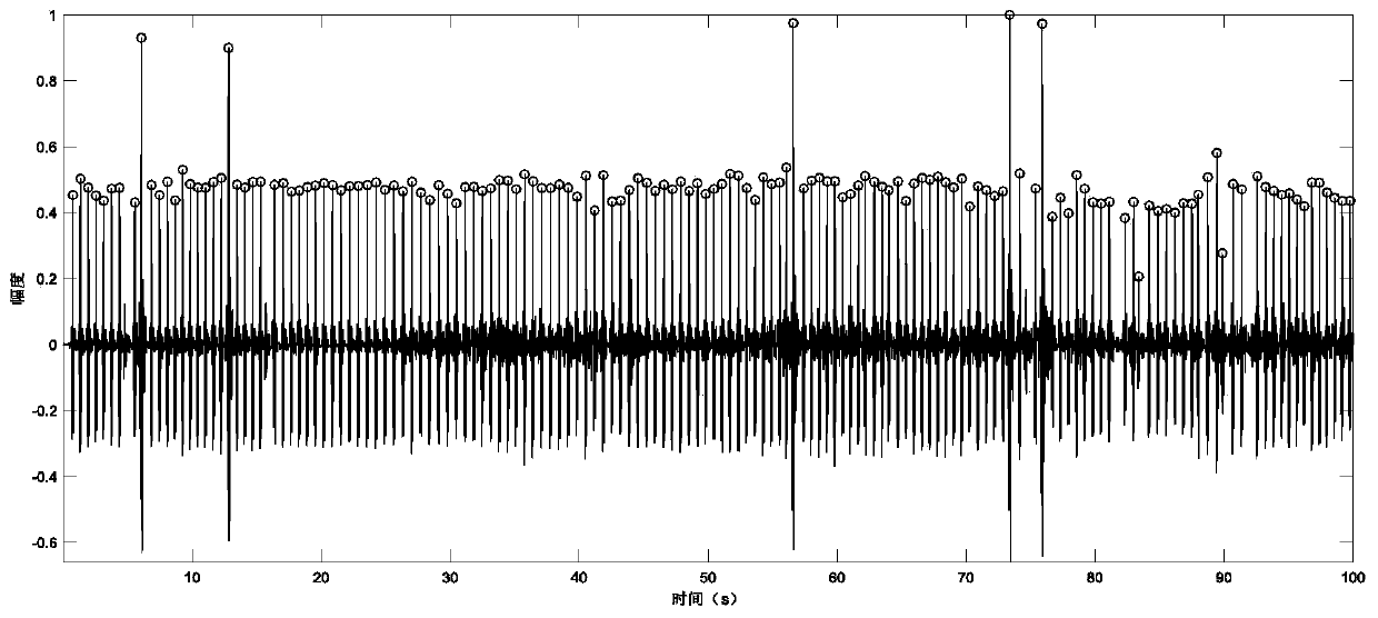 Improved electrocardiosignal quick clustering analysis method