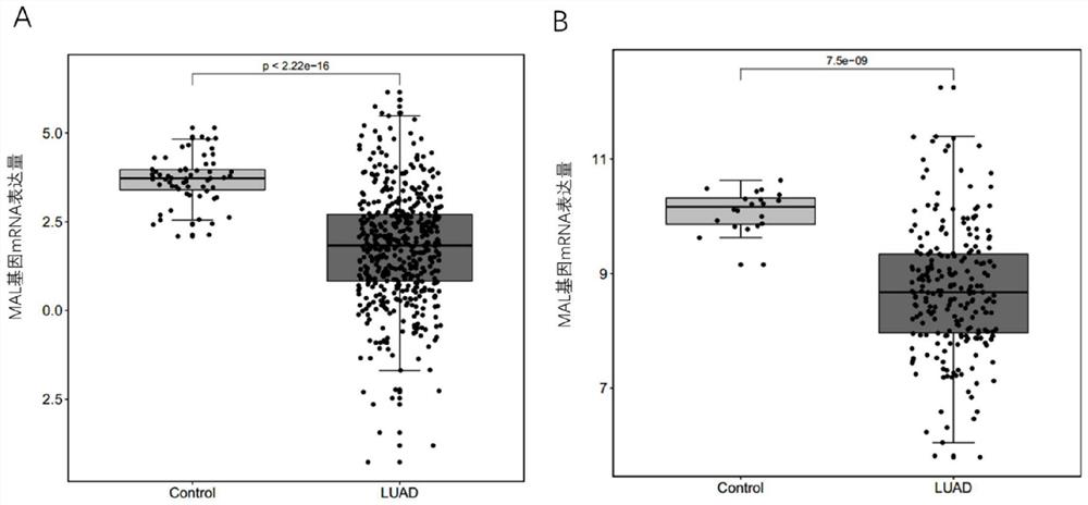 Application of gene marker combination in lung cancer screening and prognosis judgment