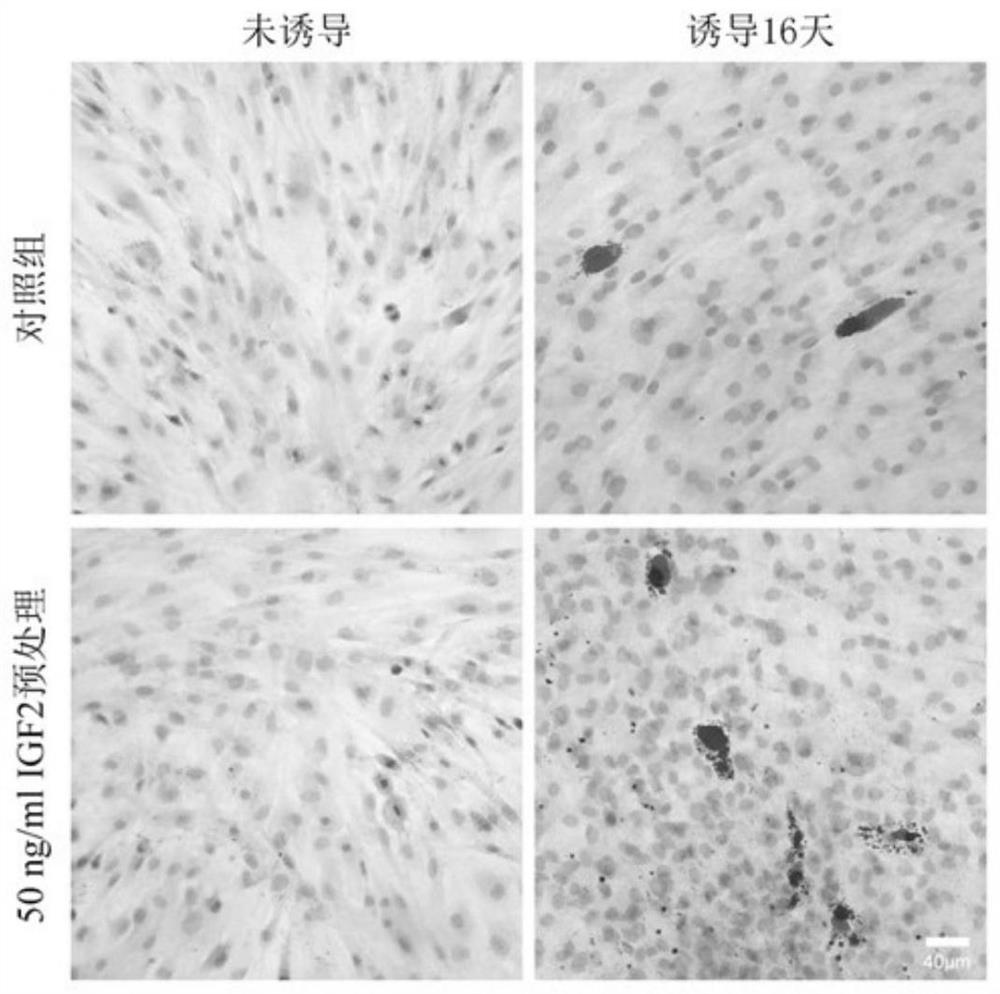 Application of insulin-like growth factor 2 in promoting the differentiation of human skin fibroblasts into adipocytes