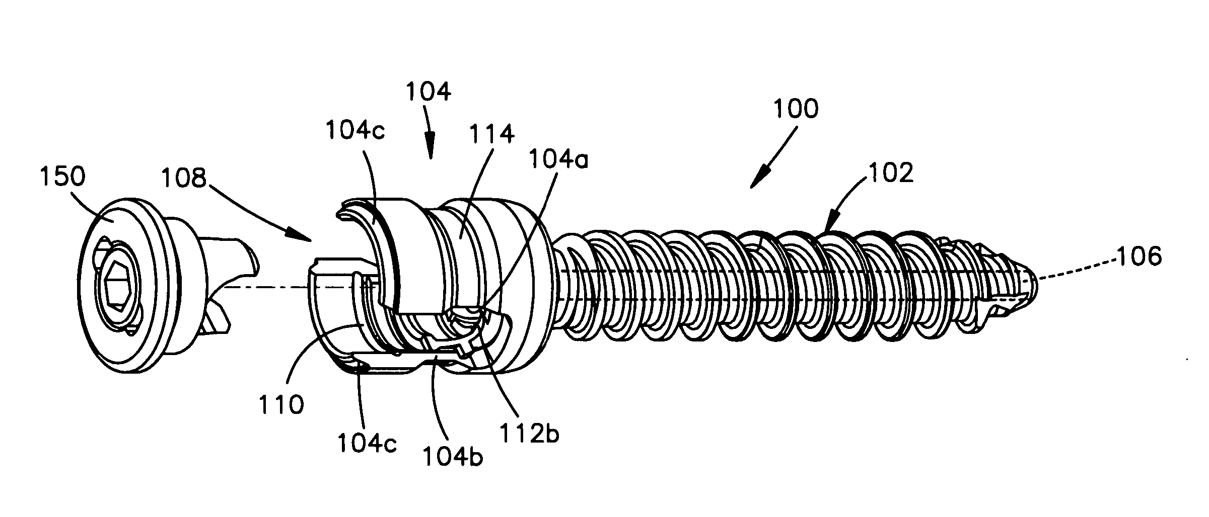 Methods of spinal fixation and instrumentation