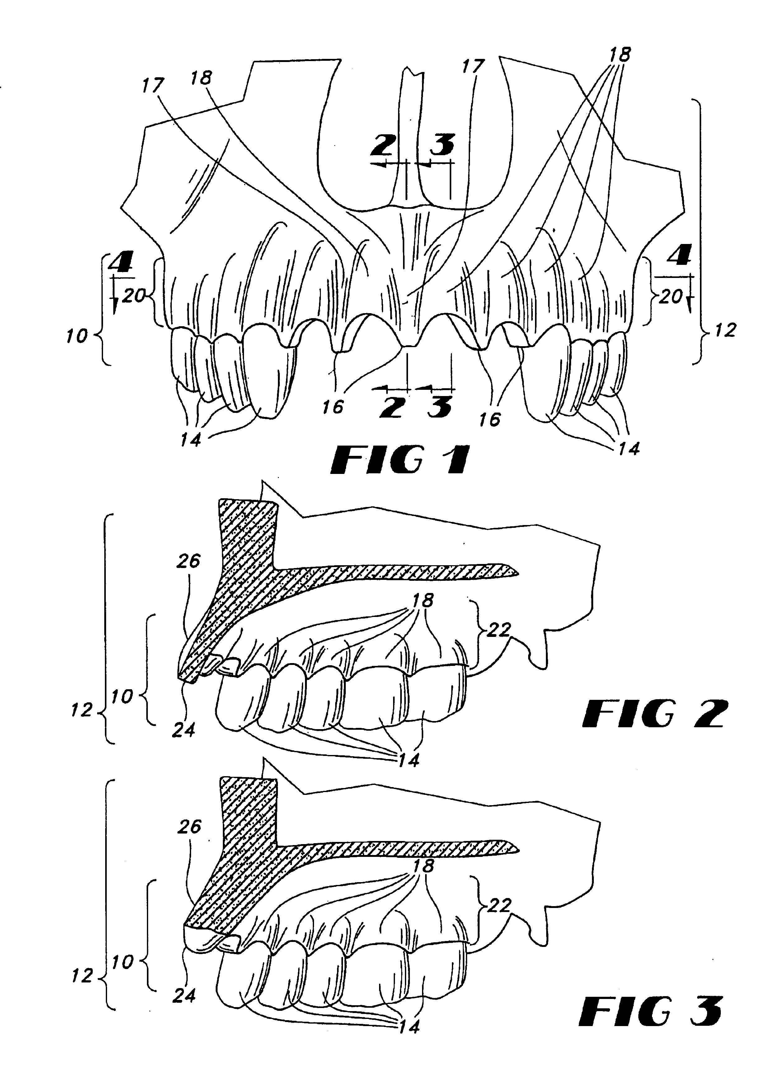 Biocompatible form and method of fabrication