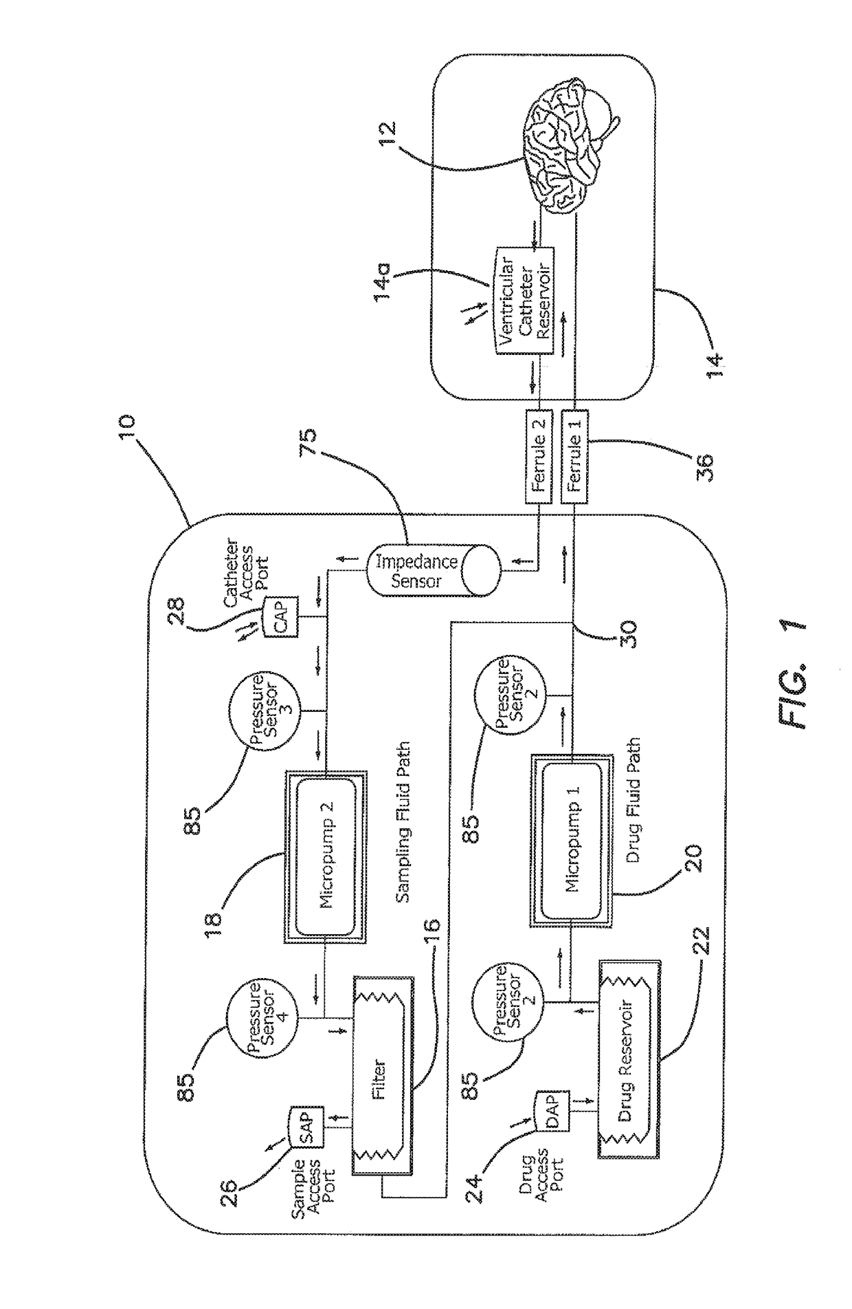 An Apparatus and Method for Cerebral Microdialysis to Treat Neurological Disease, Including Alzheimer's, Parkinson's or Multiple Sclerosis