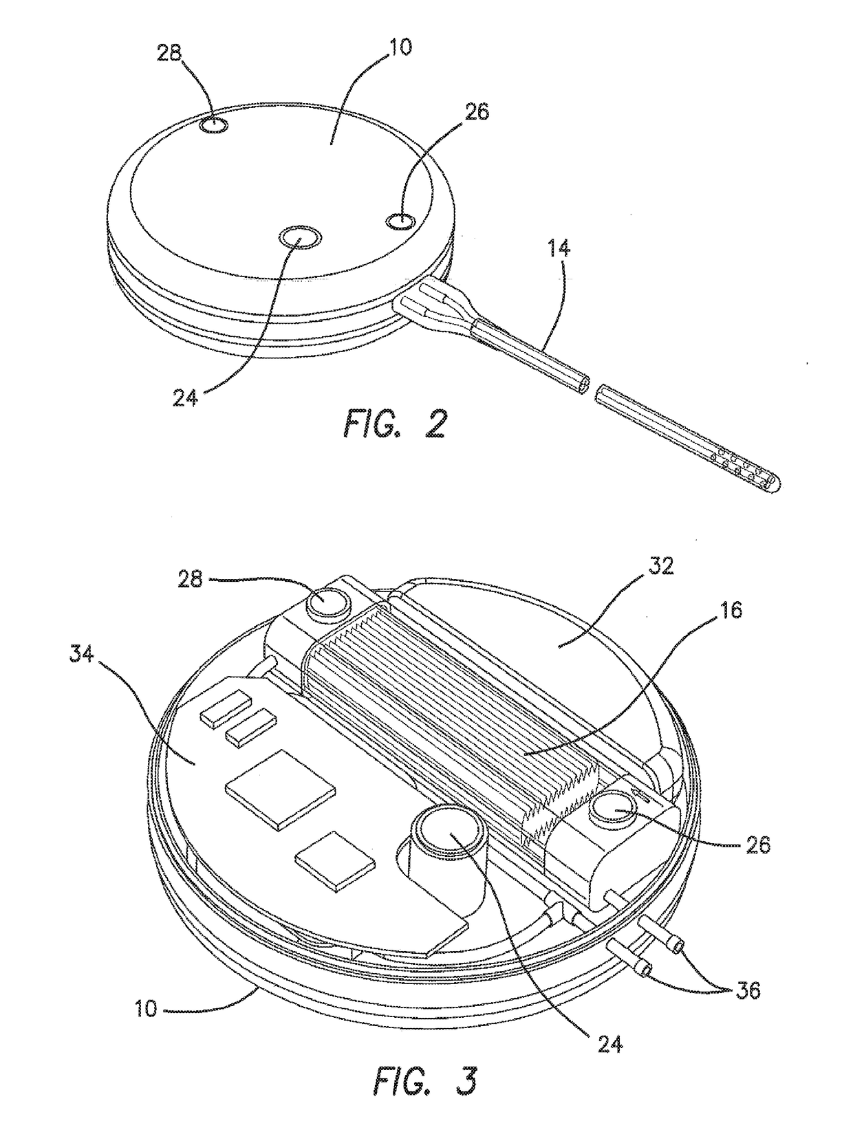 An Apparatus and Method for Cerebral Microdialysis to Treat Neurological Disease, Including Alzheimer's, Parkinson's or Multiple Sclerosis