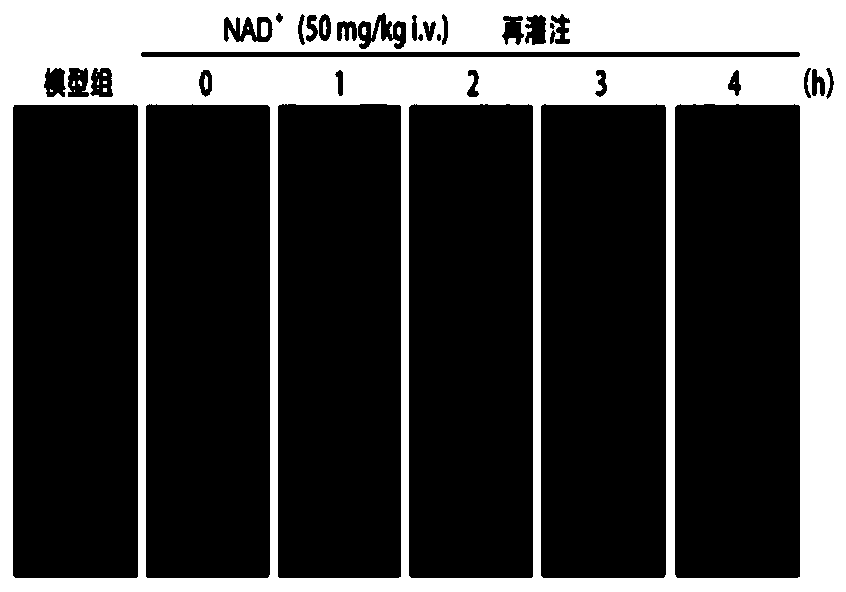 Medicine for treating ischemic stroke and its preparation method and use