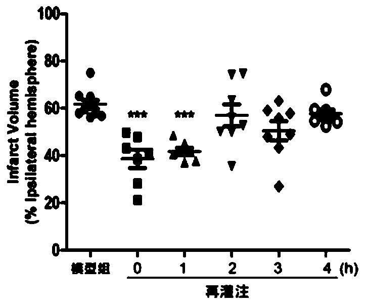 Medicine for treating ischemic stroke and its preparation method and use