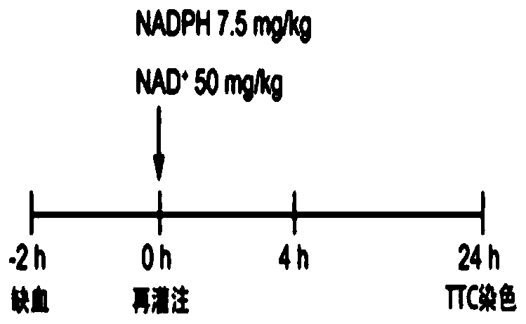 Medicine for treating ischemic stroke and its preparation method and use