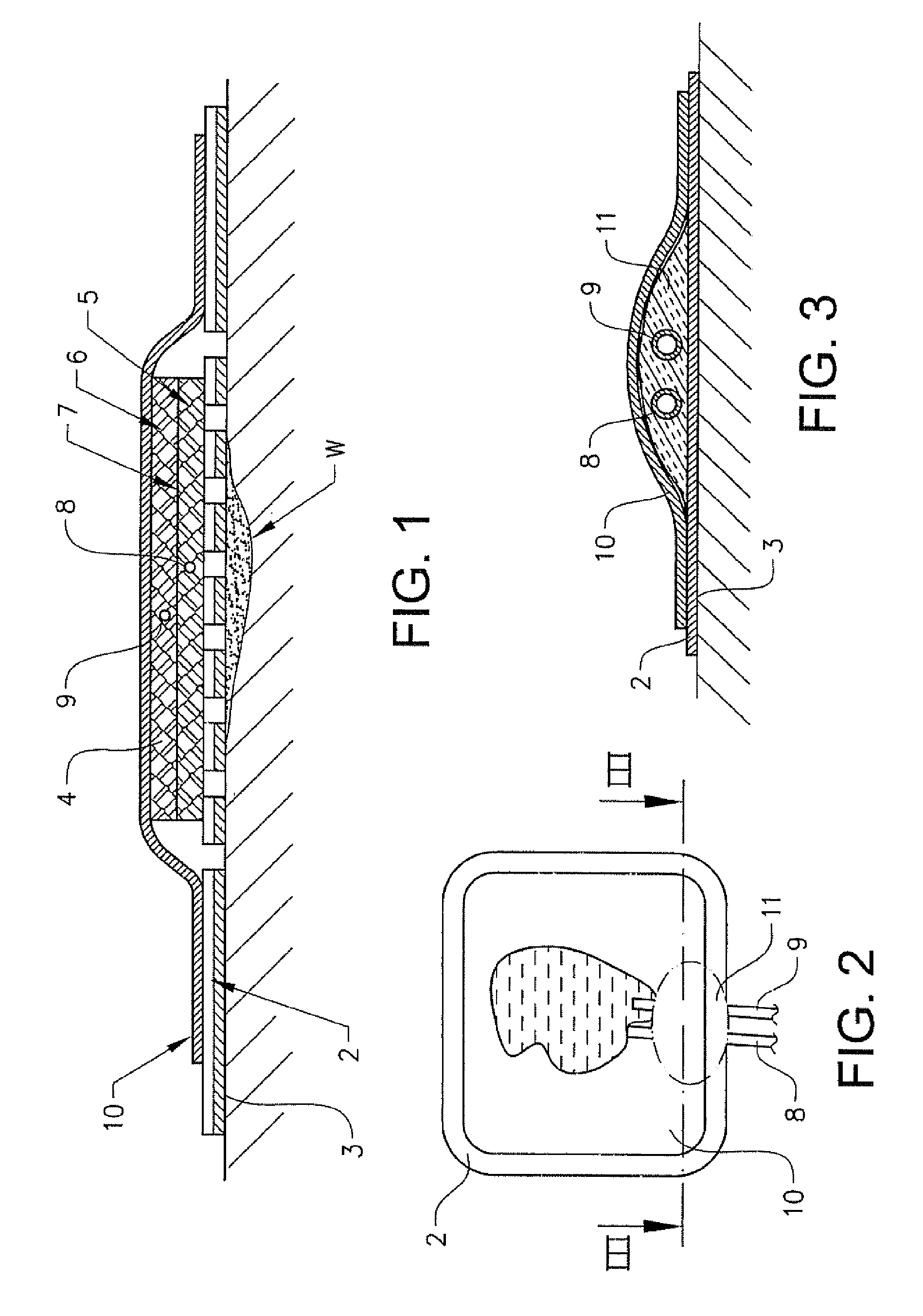 Wound dressing having pressure-distributing tube inlet