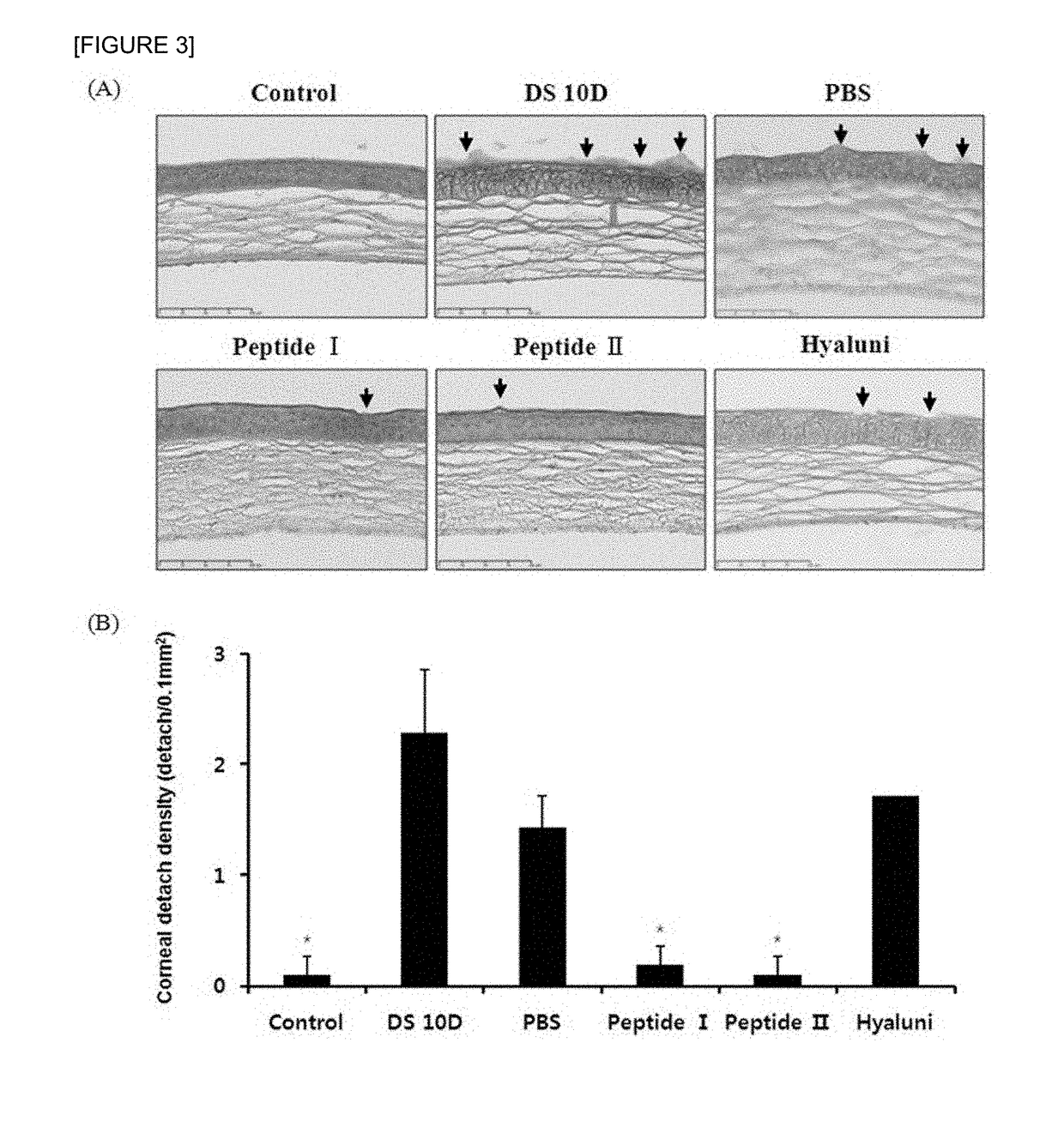 Pharmaceutical composition for preventing or treating dry eyes