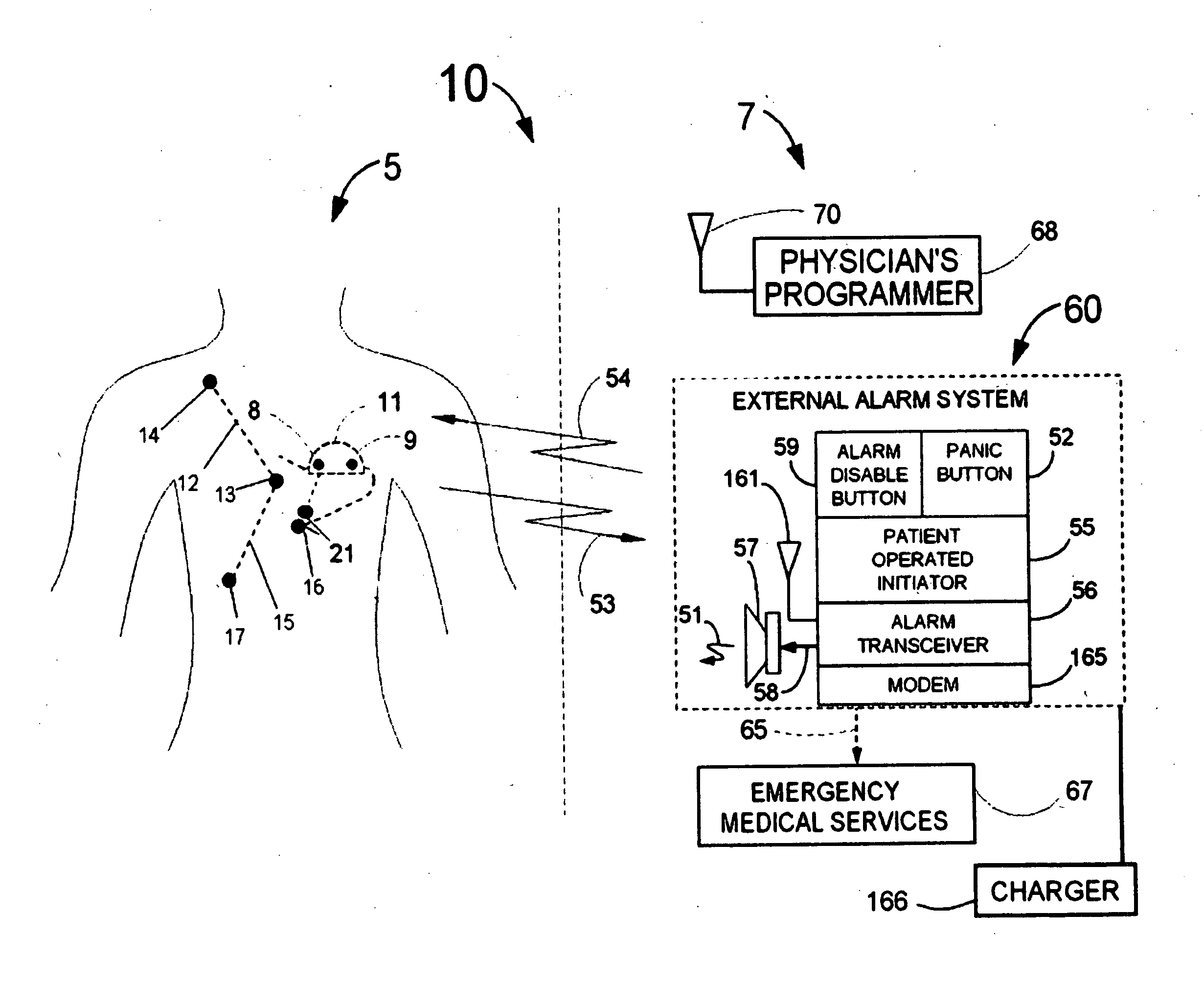 System and methods for the selective updating of heart signal parameter time series