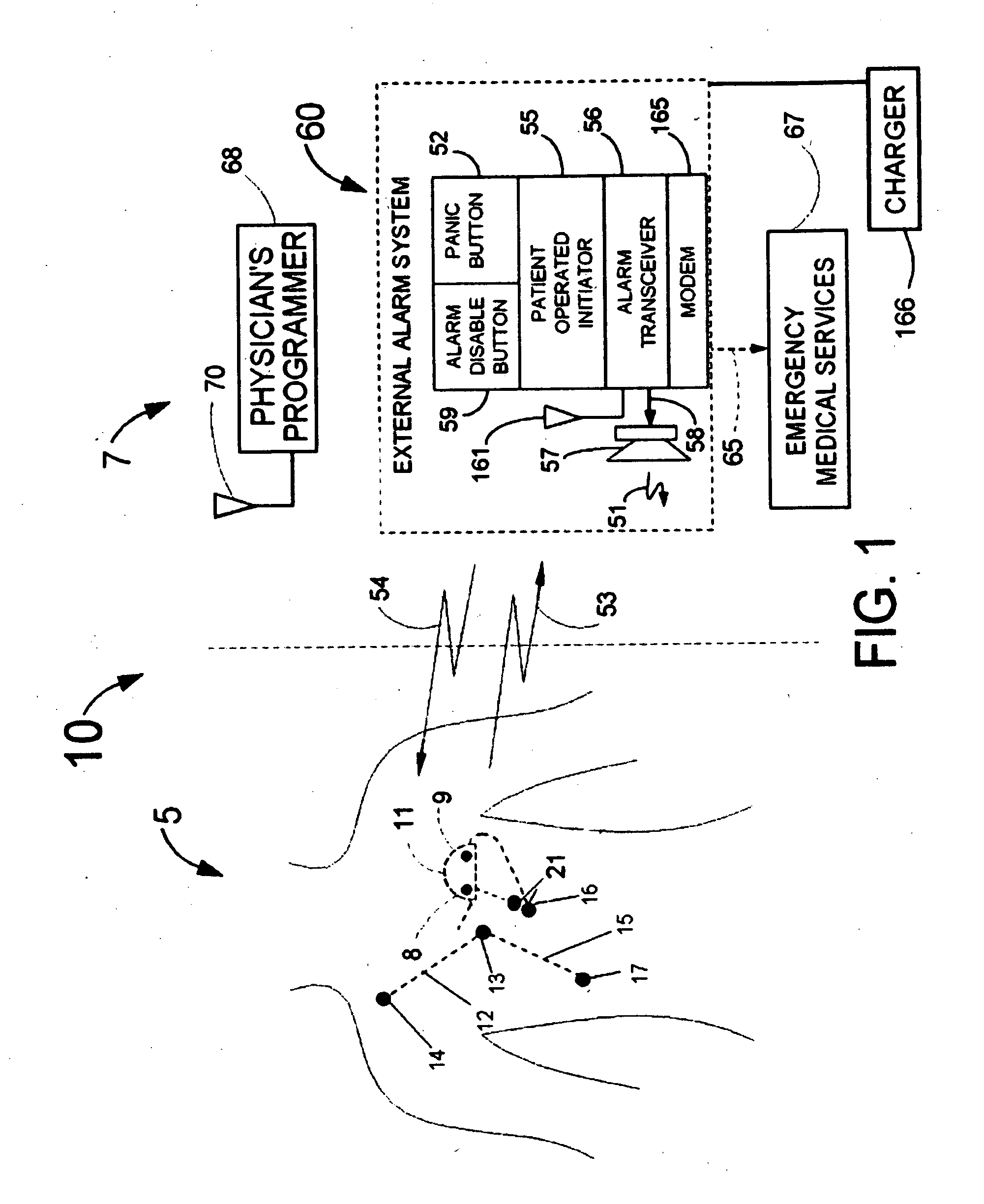 System and methods for the selective updating of heart signal parameter time series