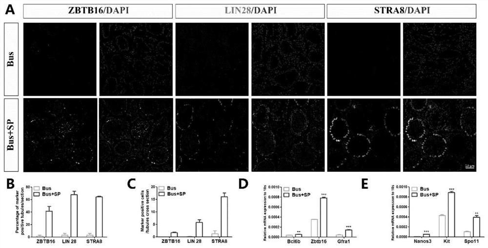 Use of sp in the preparation of medicines for treating male infertility