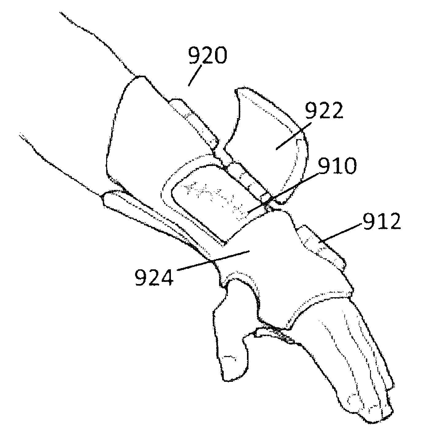 Adjustable brace