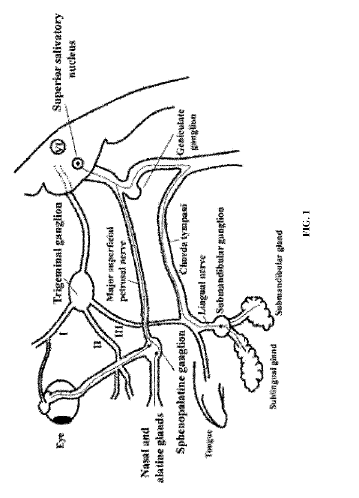 Methods and compositions for treating and preventing trigeminal autonomic cephalgias, migraine, and vascular conditions