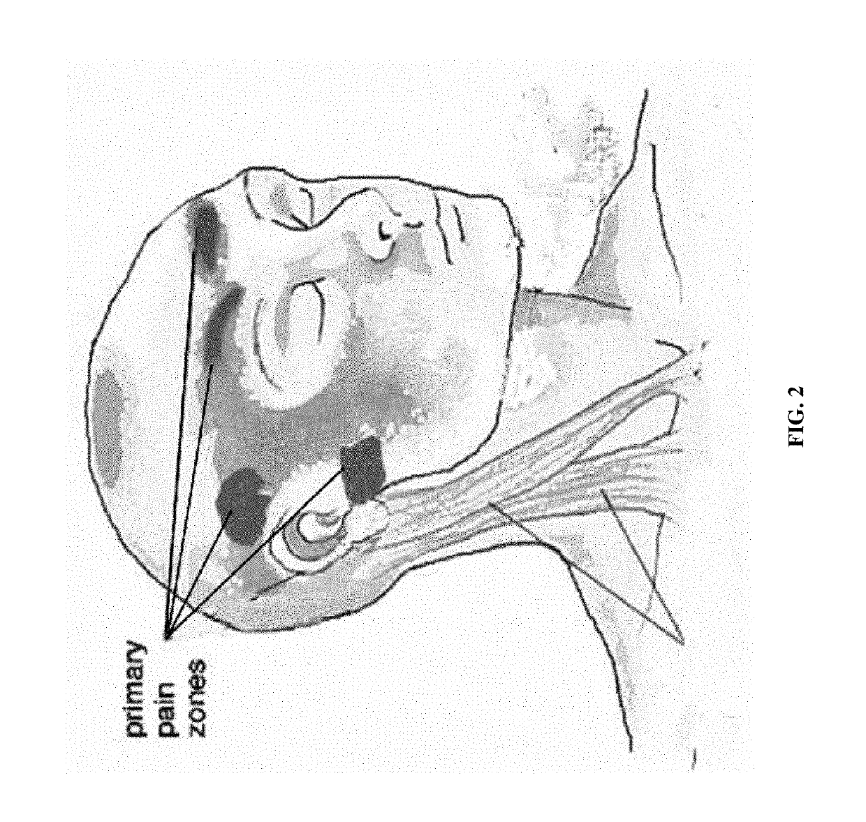 Methods and compositions for treating and preventing trigeminal autonomic cephalgias, migraine, and vascular conditions