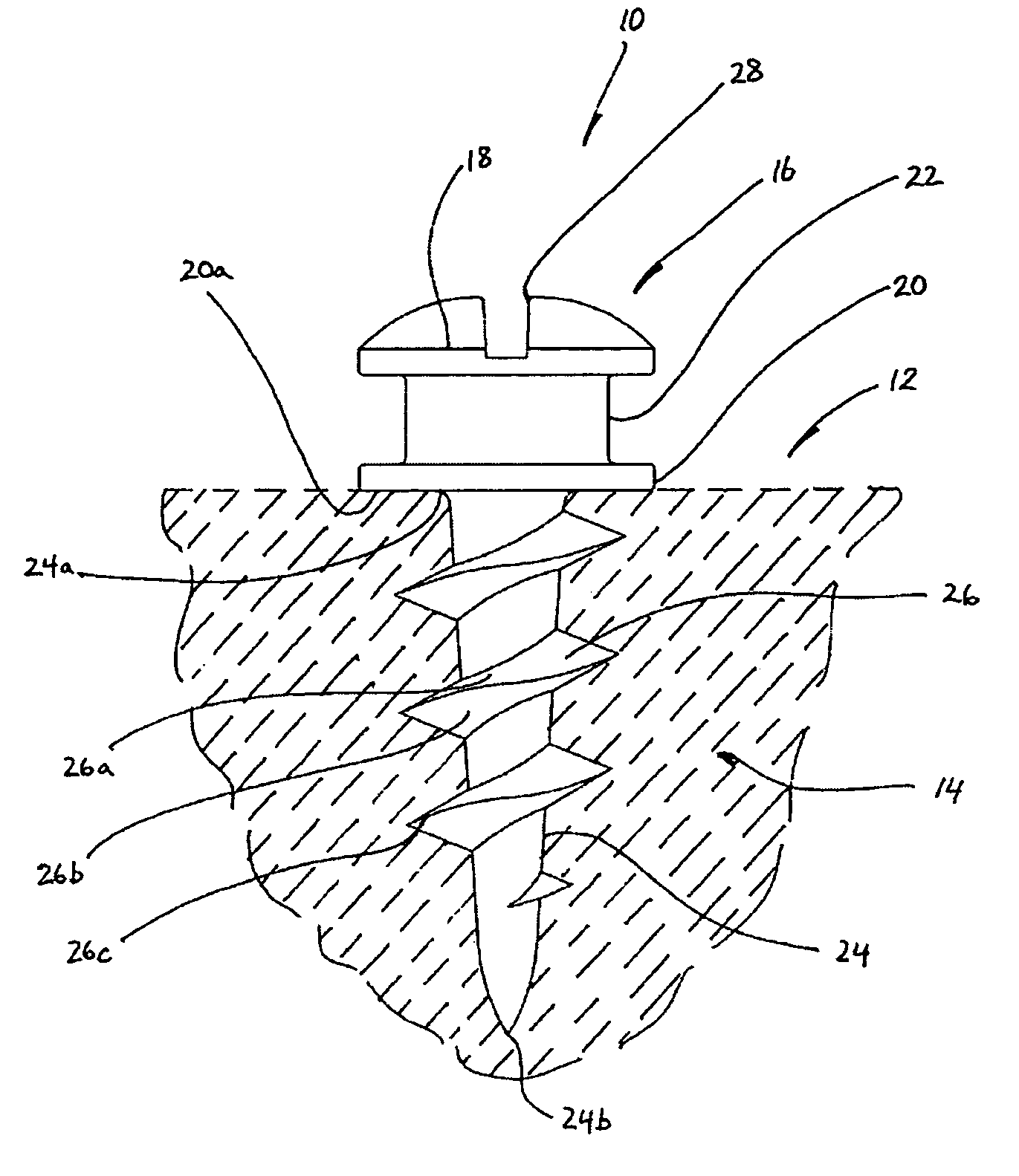 Supporting device