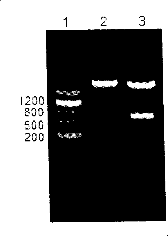 Whooping cough genetic engineering blending second unit vaccine and preparing  method thereof