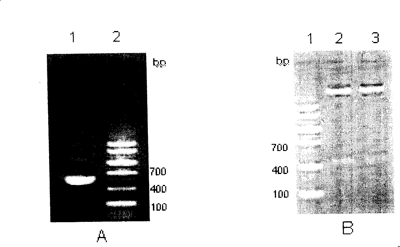 Whooping cough genetic engineering blending second unit vaccine and preparing  method thereof