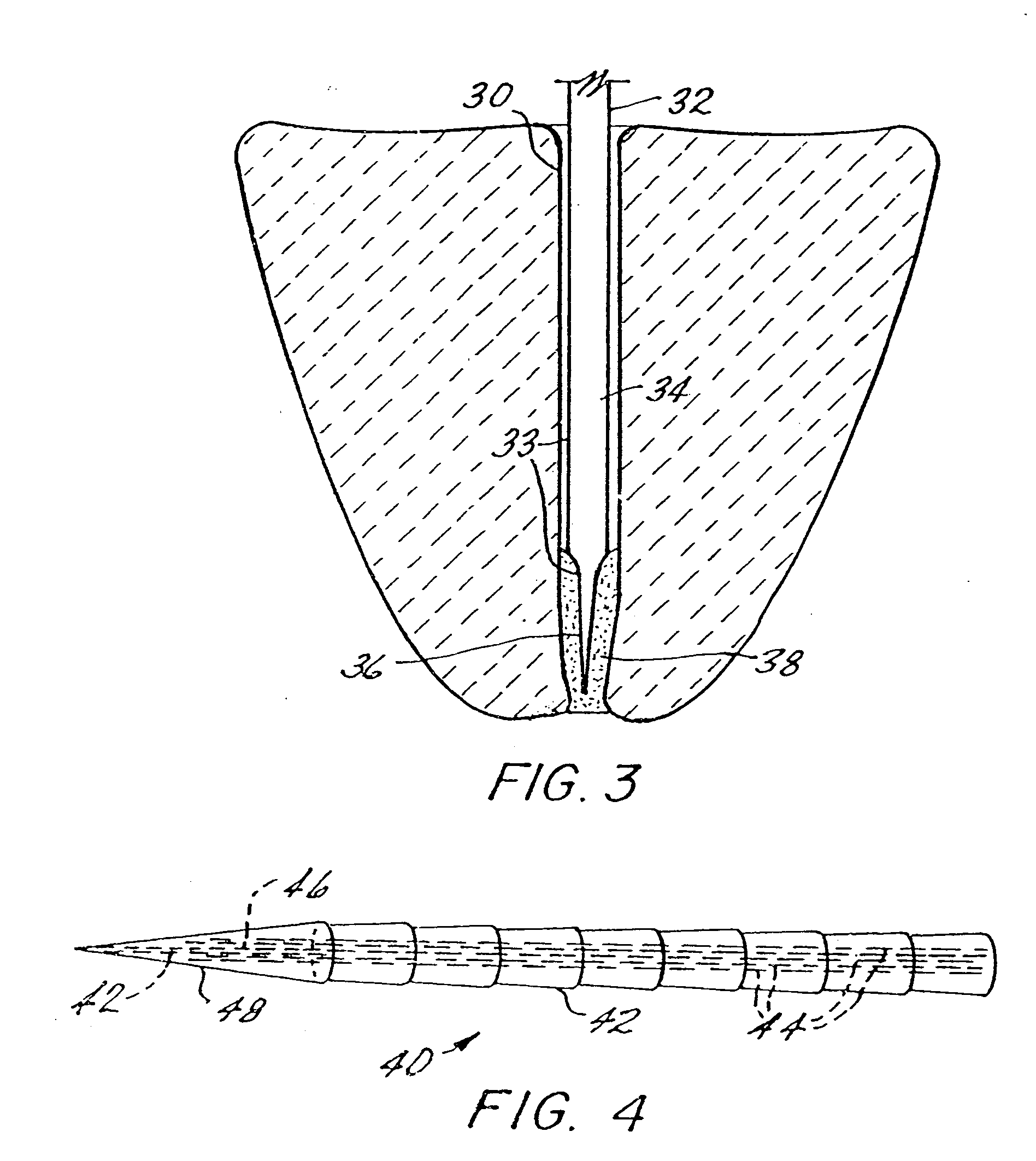 Endodontic post and obturating system