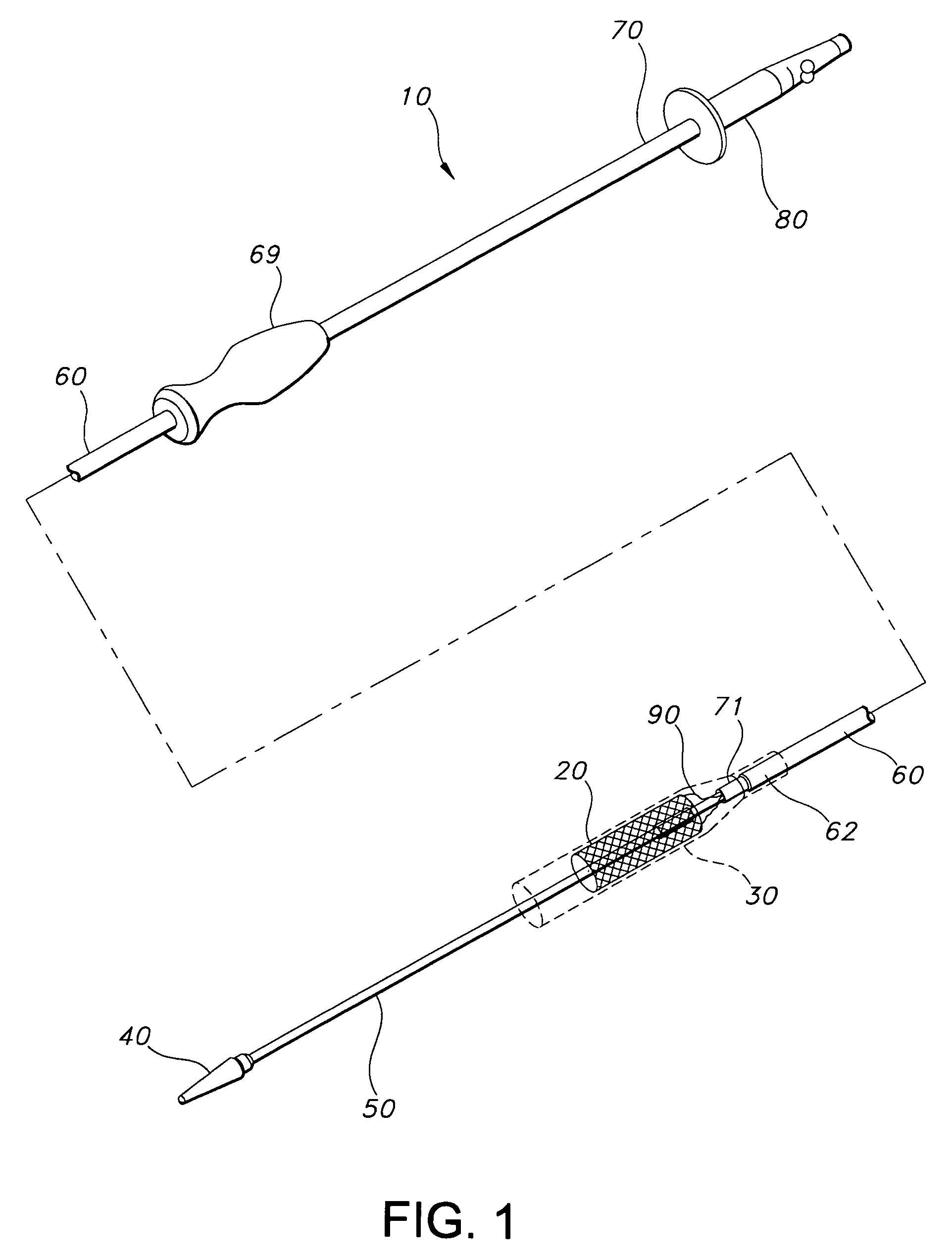 Apparatus and method for loading and delivering a stent using a suture retaining mechanism