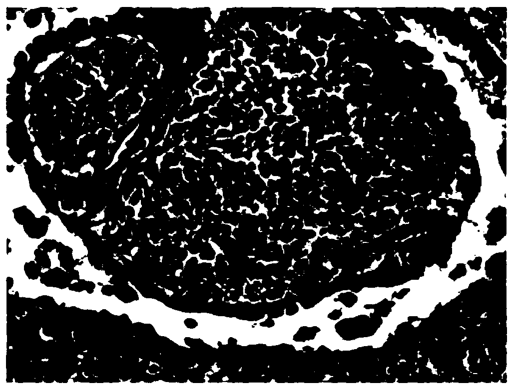 Hematoxylin staining solution and HE (hematoxylin eosin) staining solution containing hematoxylin staining solution