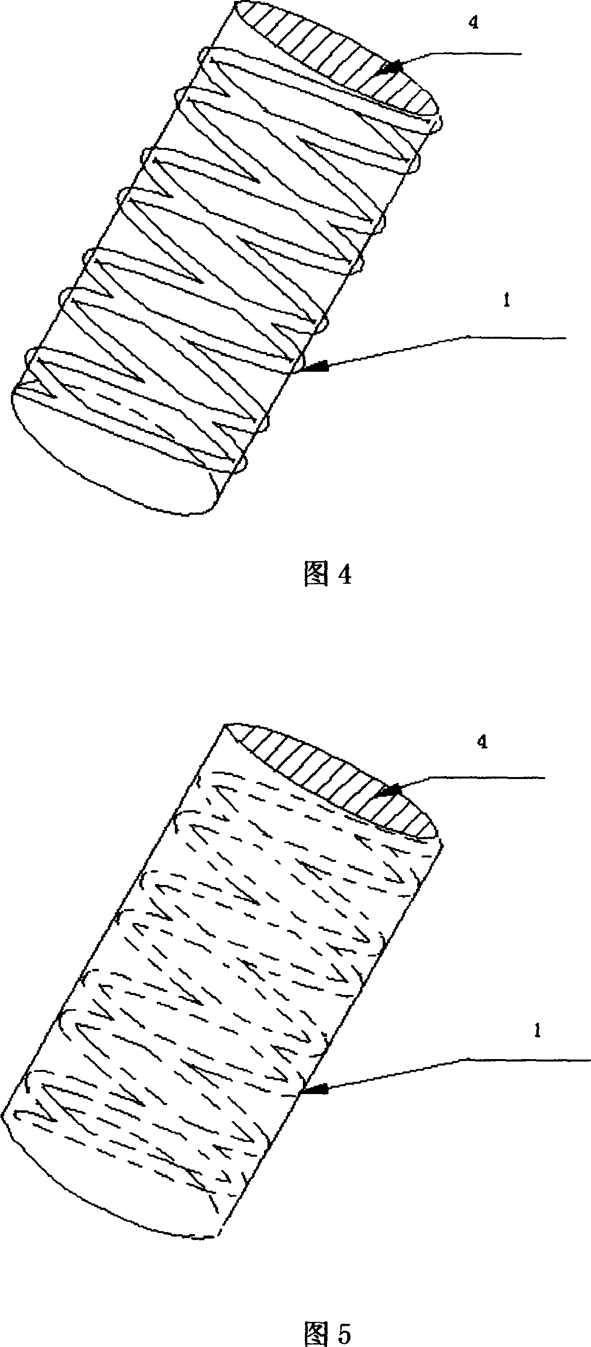 Imaginal stem cell membrane stent in blood vessel, and its preparing method