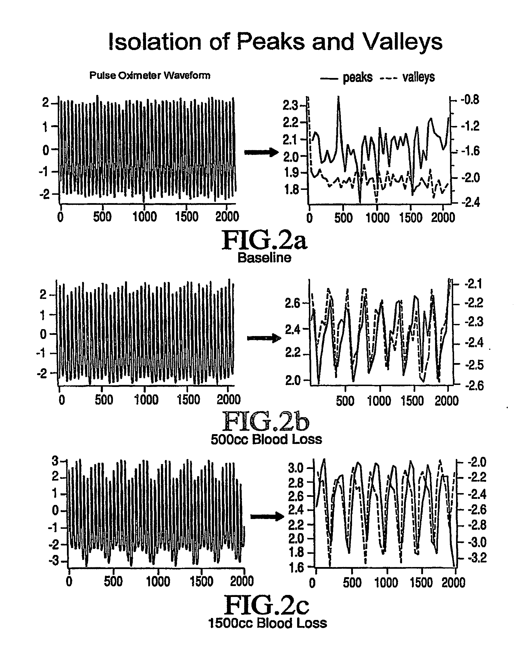 Method of Assessing Blood Volume Using Photoelectric Plethysmography