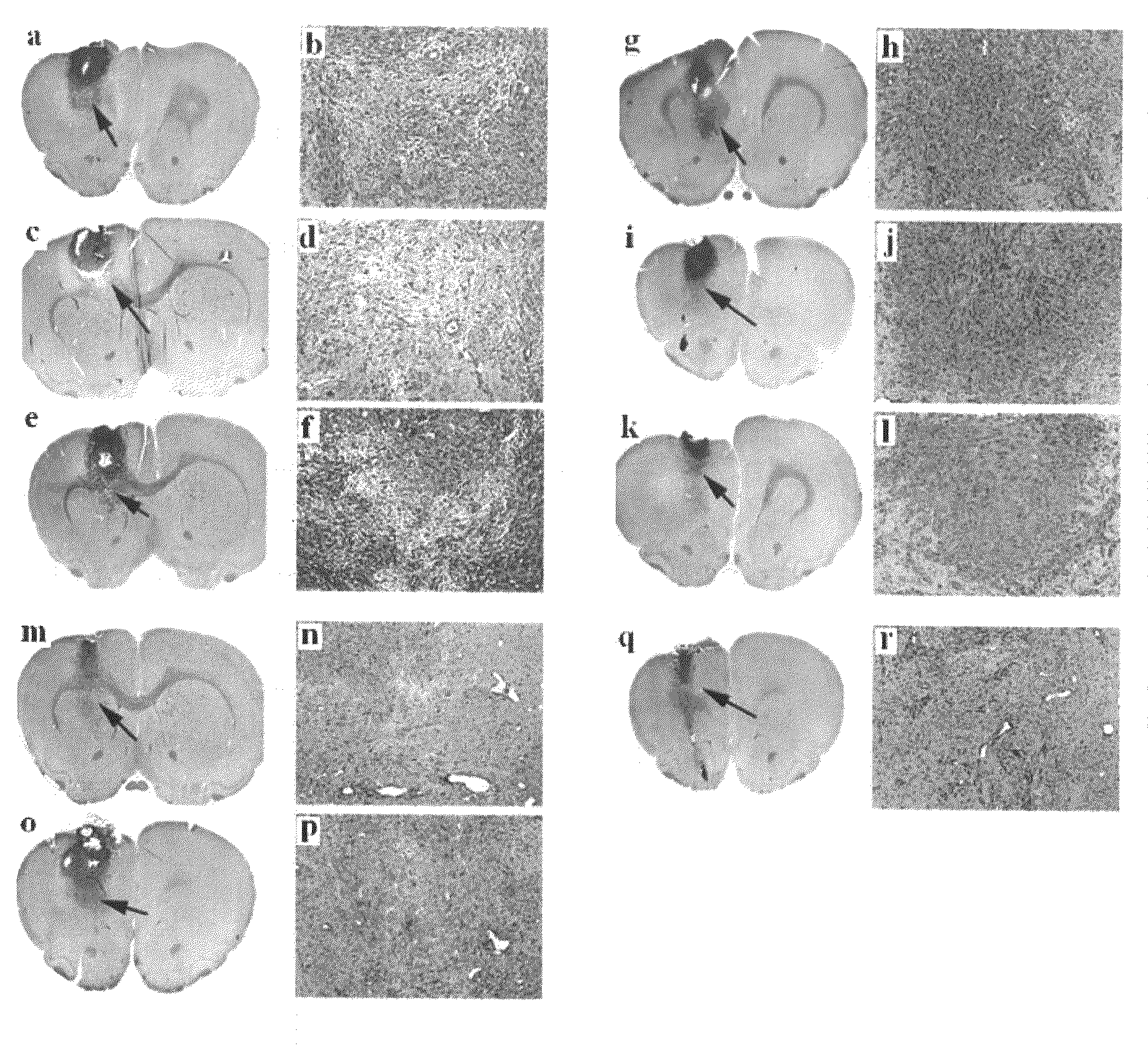 Polymer nanoparticles coated by magnetic metal oxide and uses thereof