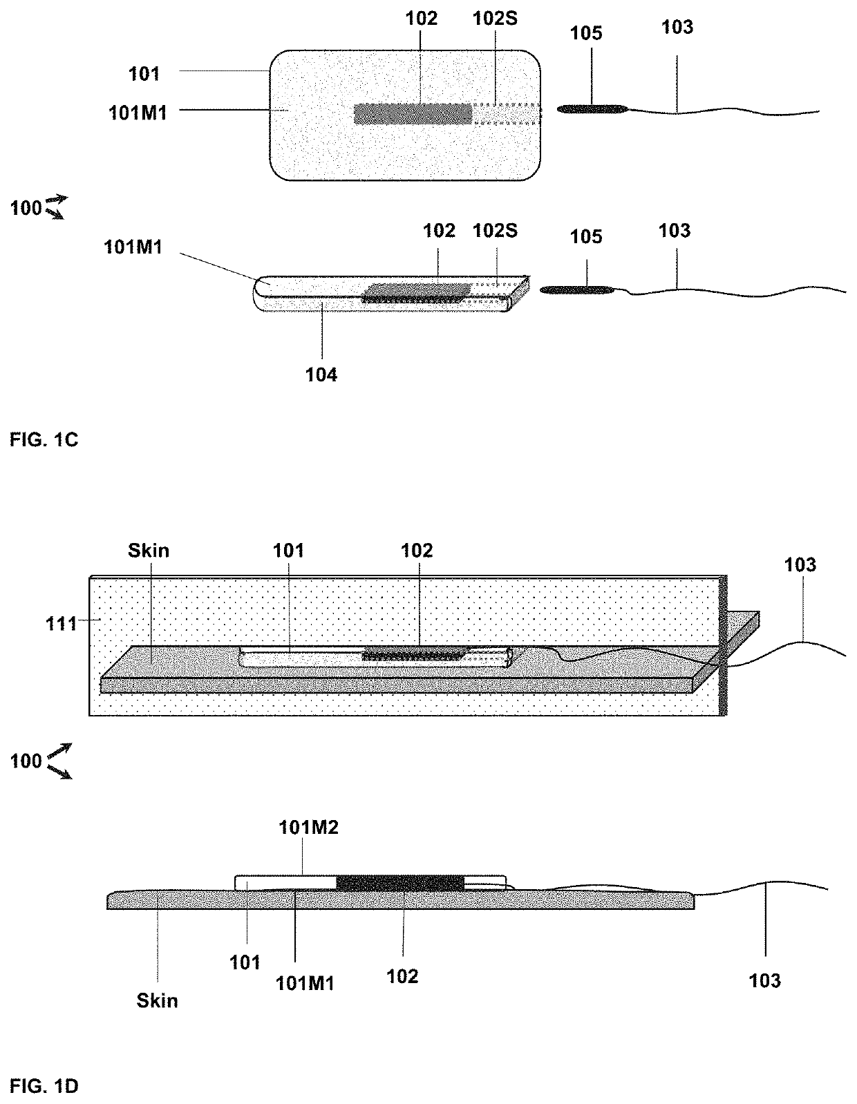 Tracking cardiac forces and arterial blood pressure using accelerometers