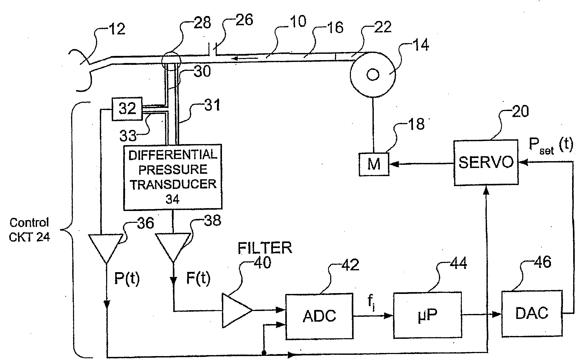 Method and apparatus for improved flow limitation detection of obstructive sleep apnea