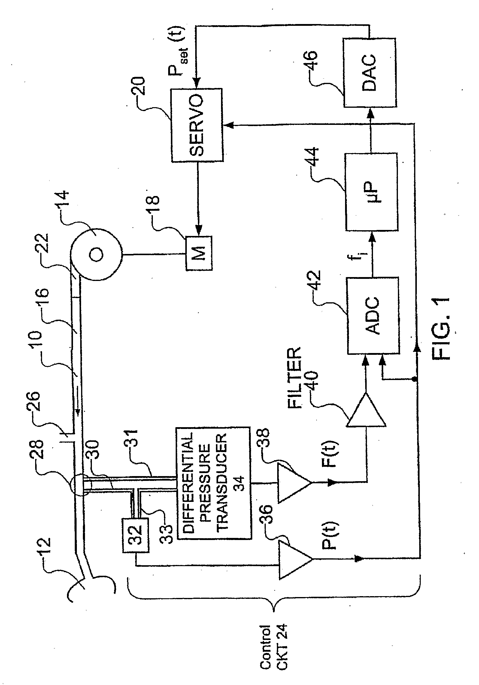 Method and apparatus for improved flow limitation detection of obstructive sleep apnea