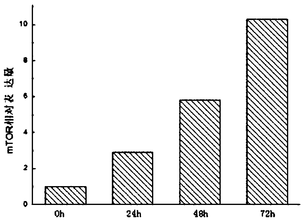 Research of molecular mechanism of IGF-1 in skeletal muscle damage repair